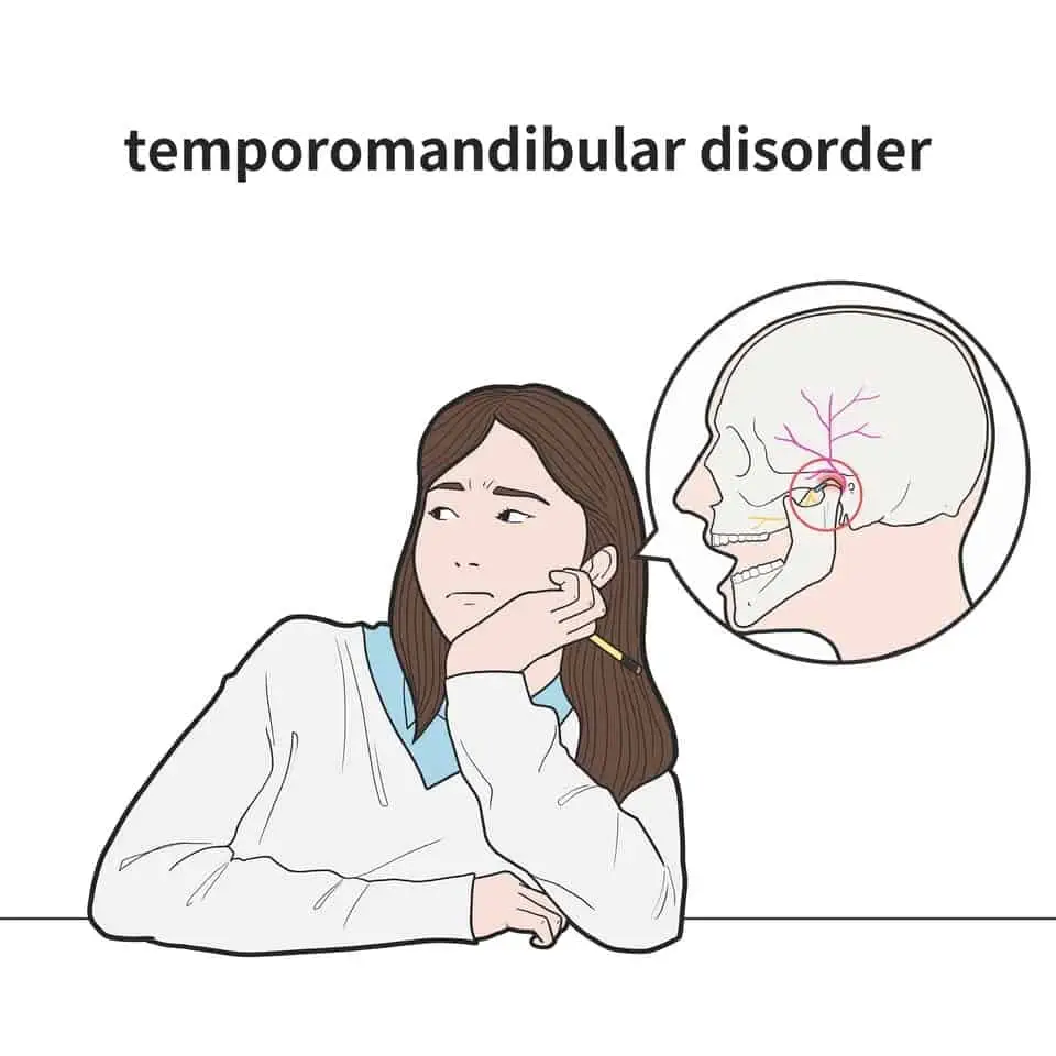 Temporallappenepilepsie ist eine Erkrankung, die durch wiederkehrende Anfälle gekennzeichnet ist, die vom Temporallappen des Gehirns ausgehen.